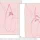 Image for article titled The (dubious) science of penis enlargement